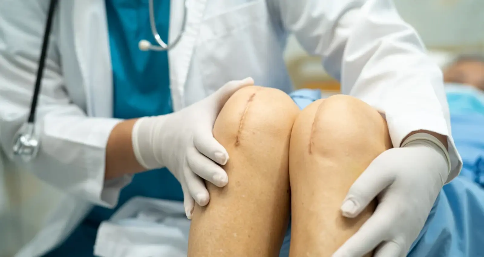 Knee Replacement