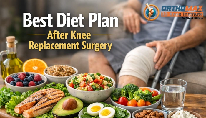 Best Diet Plan After Knee Replacement Surgery